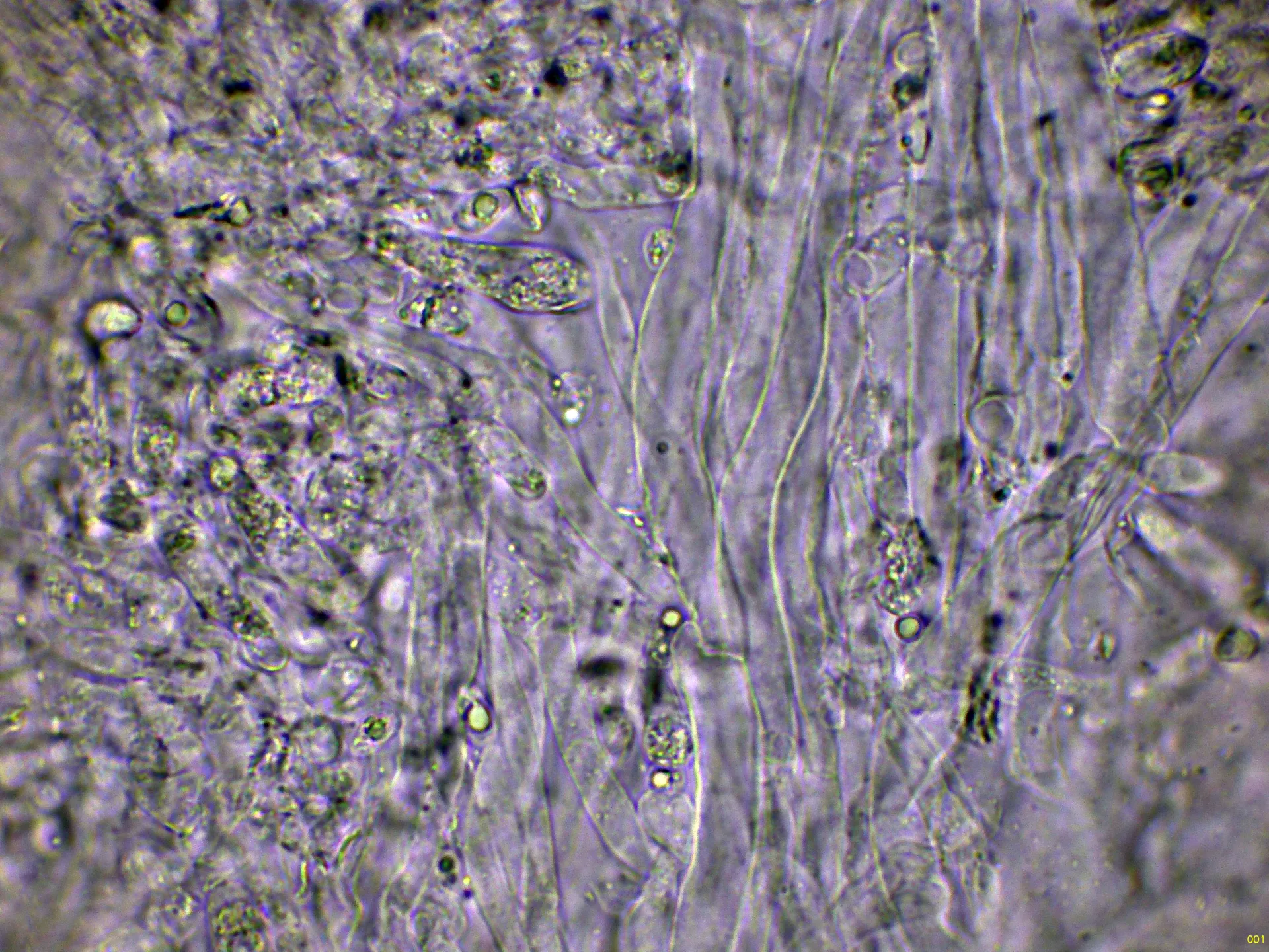 Microscopía de Tricholoma lascivum - 10 - Trama amoniaco-001